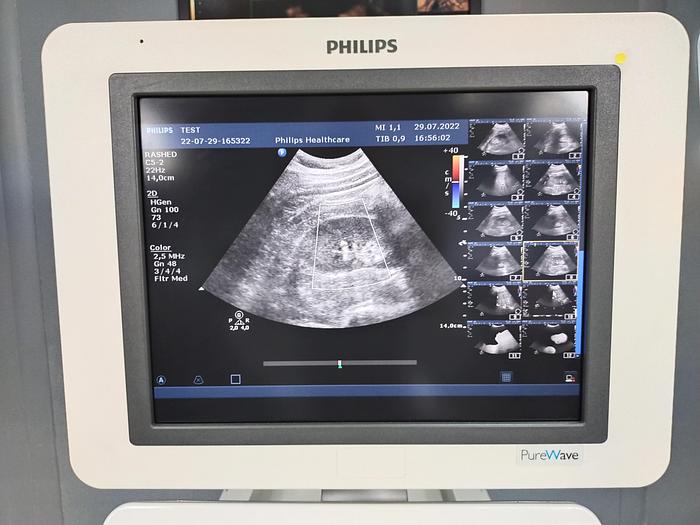 Gebraucht Philips HD15 Purewave Diagnostik Ultraschallsystem mit zwei Sonden und Printer SW 3.0.1