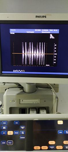 Gebraucht Philips Pencil transducer D5cwc