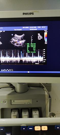 Gebraucht Philips C8-5 Microkonvex Sonde