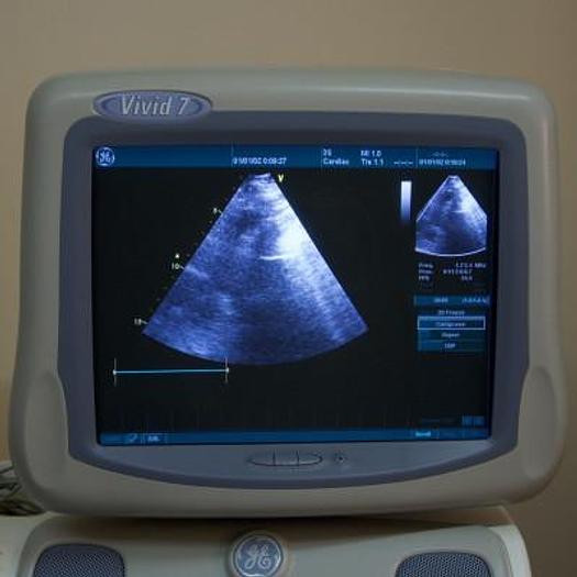 Gebraucht ECHOCARDIOGRAPHE GENERAL ELECTRIC GE VIVID 7 AVEC SONDE CARDIAQUE 3S