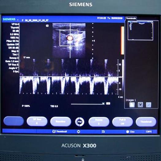 D'occasion ECHOGRAPHE SIEMENS ACUSON X300 AVEC 4 SONDES ET ECRAN PLAT