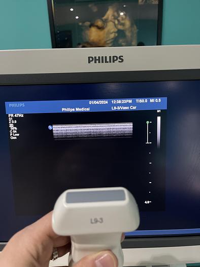 Gebraucht Philips iU22 Ultraschallgerät mit drei Ultraschallsonden