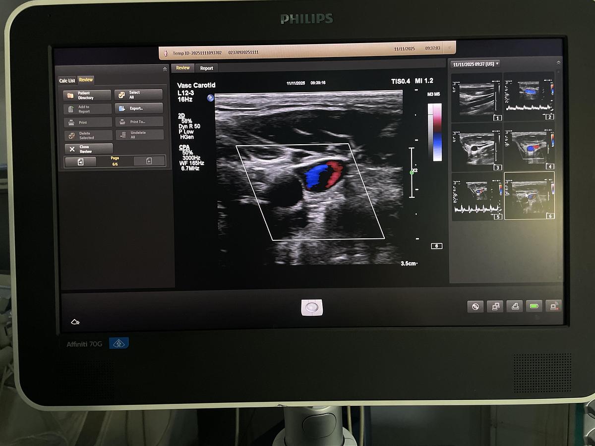 Gebraucht Philips L12-3 Linear Ultraschallsonde 