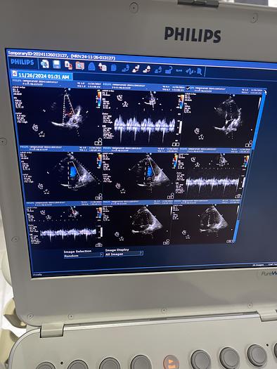 Used Philips S5-1 Sektor Ultraschallsonde