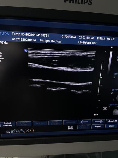 Gebraucht Philips iU22 Ultraschallgerät mit drei Ultraschallsonden