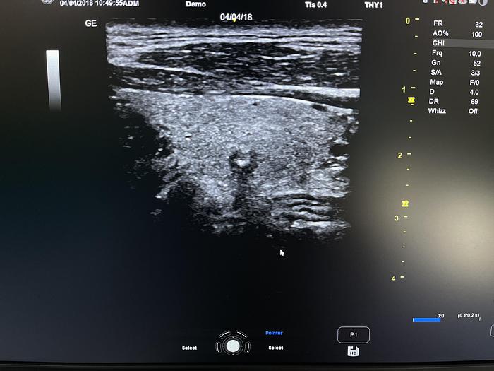 Gebraucht GE Versana Premier Ultraschallgerät mit drei Sonden
