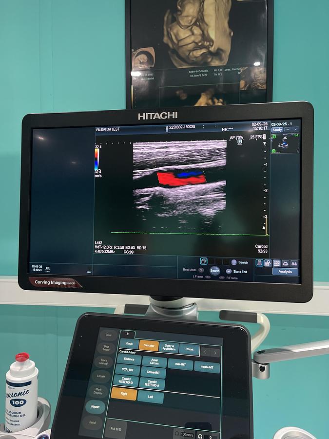 Gebraucht Hitachi ALOKA Arietta 850 Ultraschallgerät mit zwei Sonden und Drucker