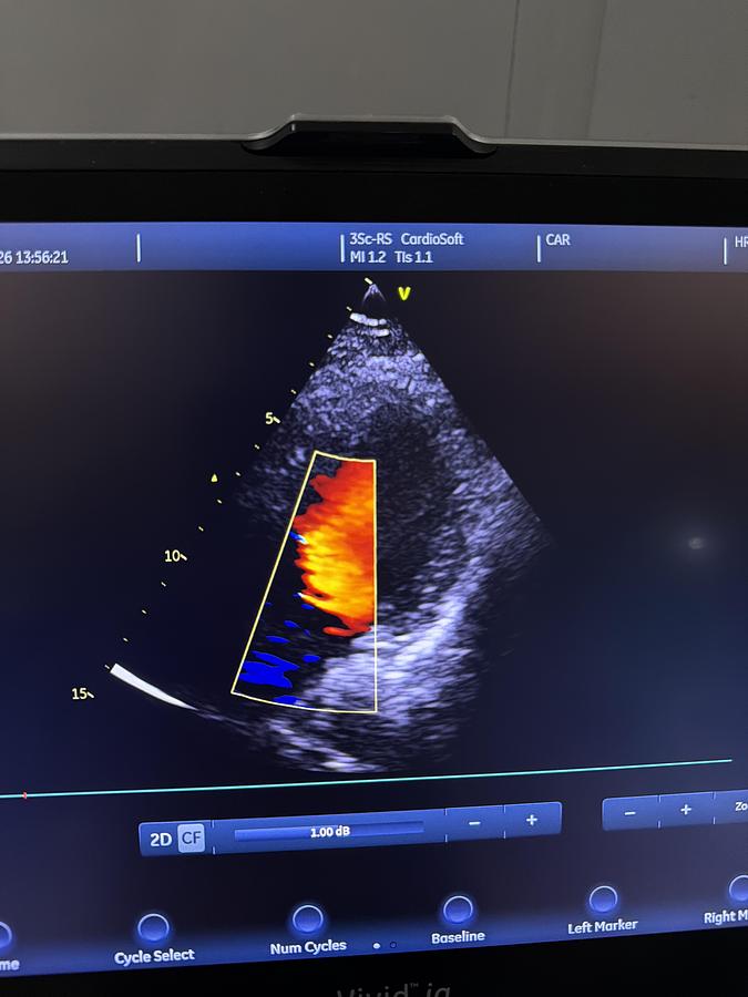 Gebraucht GE 3SC-RS Kardio Ultraschallsonde
