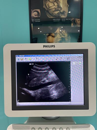 Used Philips HD7 XE Ultraschallgerät mit zwei Sonden und Drucker 