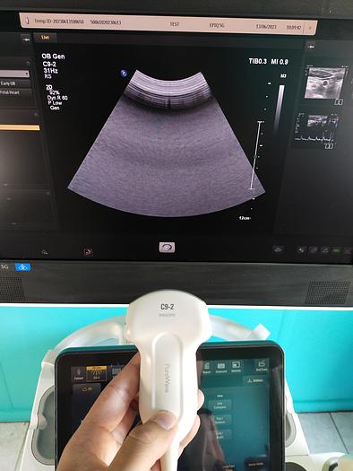 Gebraucht Philips Epiq 5G Flat Screen Ultrasound Scanner