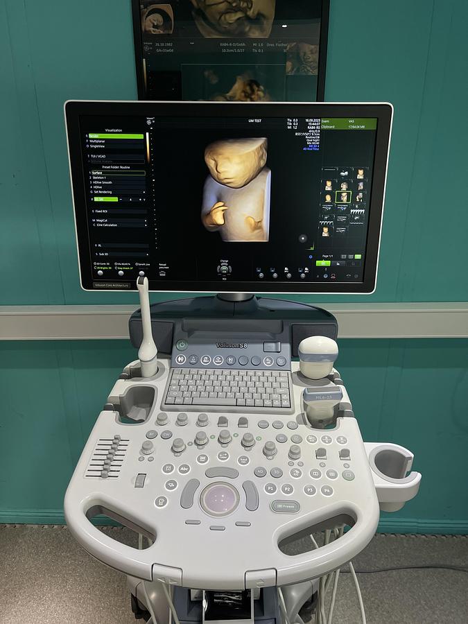 Gebraucht GE Voluson S8 Ultraschallgerät mit drei Sonden und Drucker