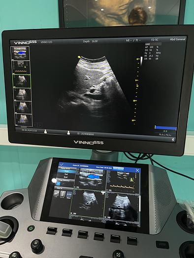 Used Vinno G55 Ultraschallgerät mit Konvex Sonde