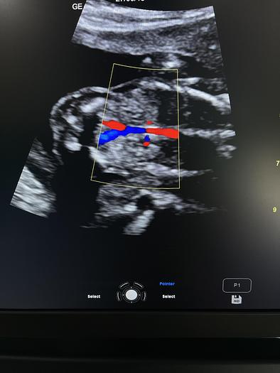 Gebraucht GE Versana Premier Ultraschallgerät mit drei Sonden