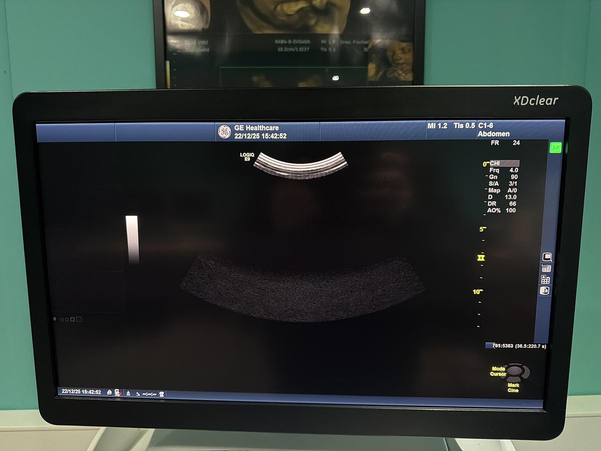 Gebraucht GE LOGIQ E9 XDClear Elastography Ultraschallgerät mit zwei Sonden  