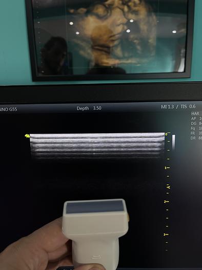 Used Vinno G55 Ultraschallgerät mit Konvex Sonde