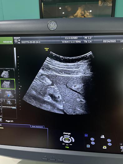 Gebraucht GE C1-5-D konvex Ultraschallsonde