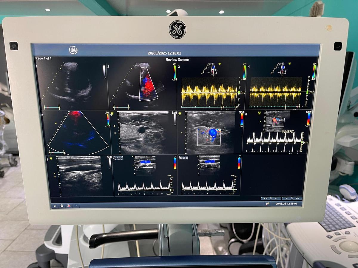 Gebraucht GE Vivid S70 Ultraschallgerät mit zwei Sonden 