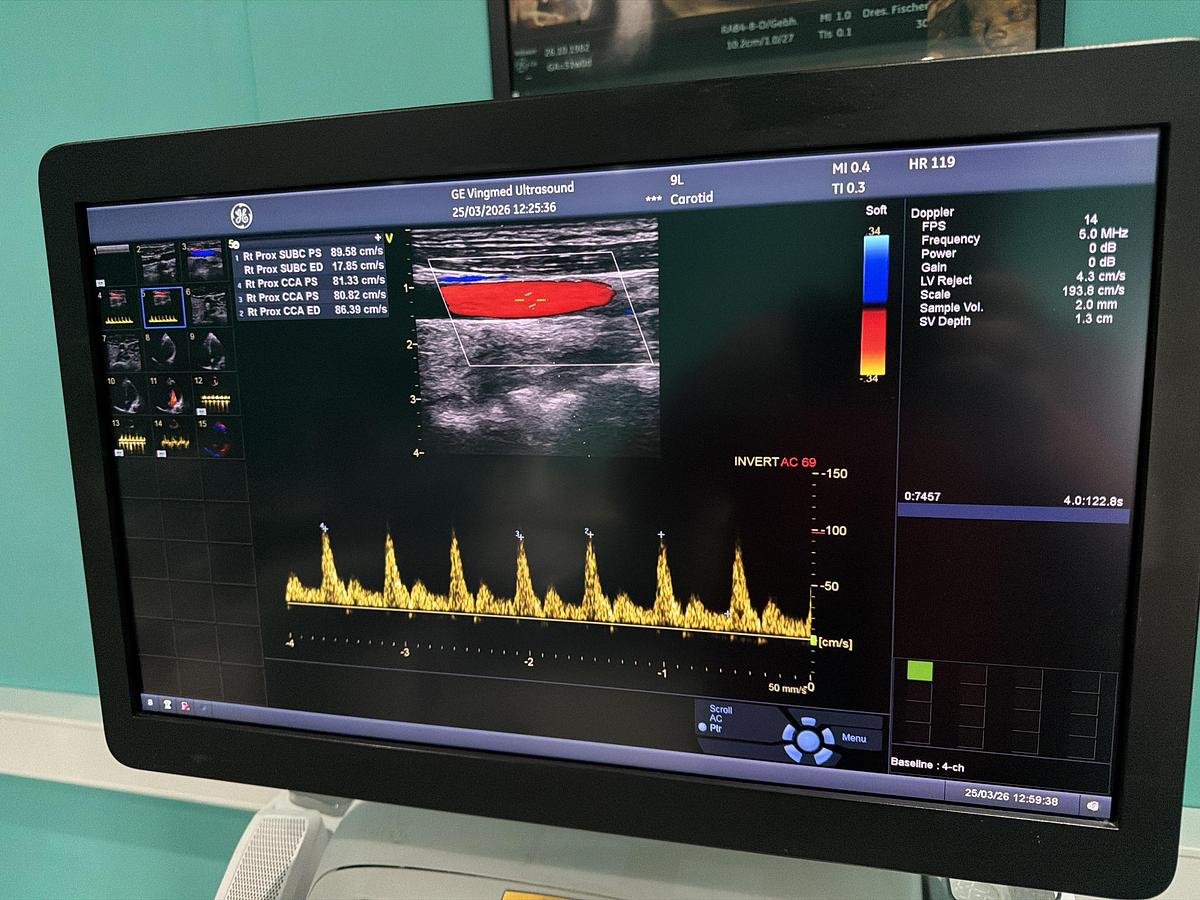 Gebraucht GE Vivid E95 v202 Ultraschallgerät mit zwei Sonden 