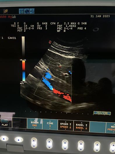 Gebraucht Esaote MyLab30CD Ultraschallgerät mit zwei Sonden