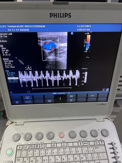 Gebraucht Philips L15-7io Linear Ultraschallsonde