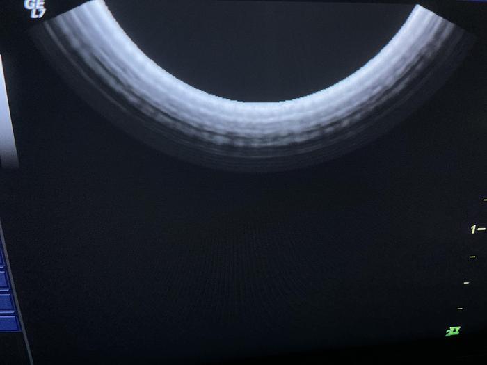 Gebraucht GE E8C Endovaginal Ultraschallsonde 