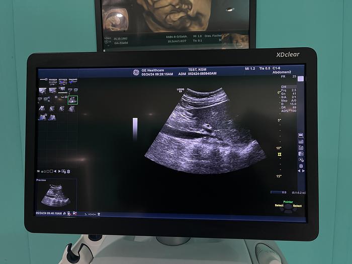 Gebraucht GE LOGIQ E9 XDClear 2.0 SW R6 Ultraschallgerät