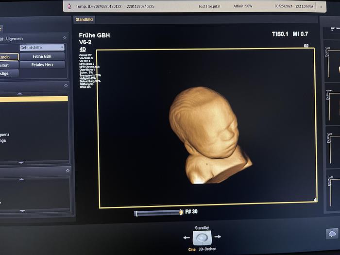 Gebraucht Philips V6-2 3D/4D Volumen Ultraschallsonde