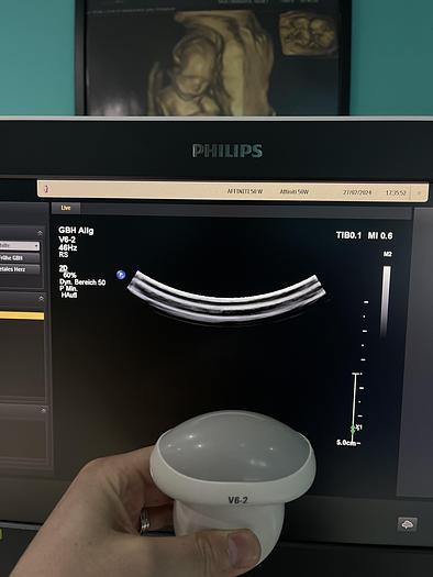 Gebraucht Philips Affiniti 50W Ultraschallgerät mit 3 Sonden und Drucker SV 9.0.5