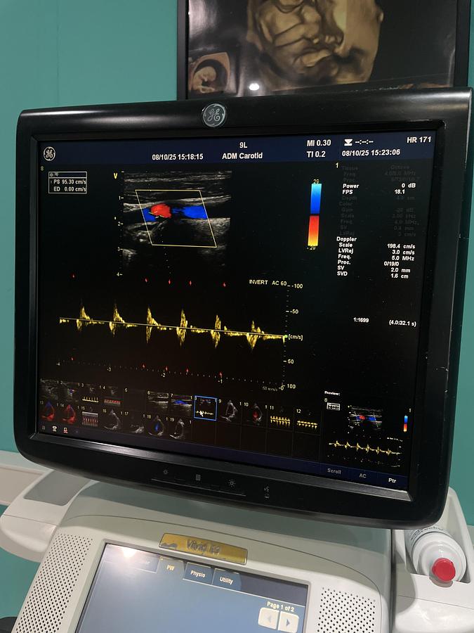 Gebraucht GE Vivid E9 Ultraschallgerät mit zwei Sonden und Drucker