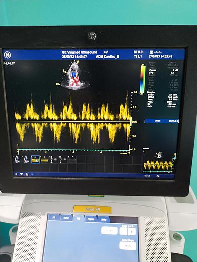 Gebraucht GE Vivid E9 Ultraschallgerät