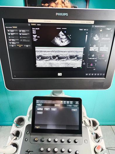 Gebraucht Philips ultrasound Probe S4-2