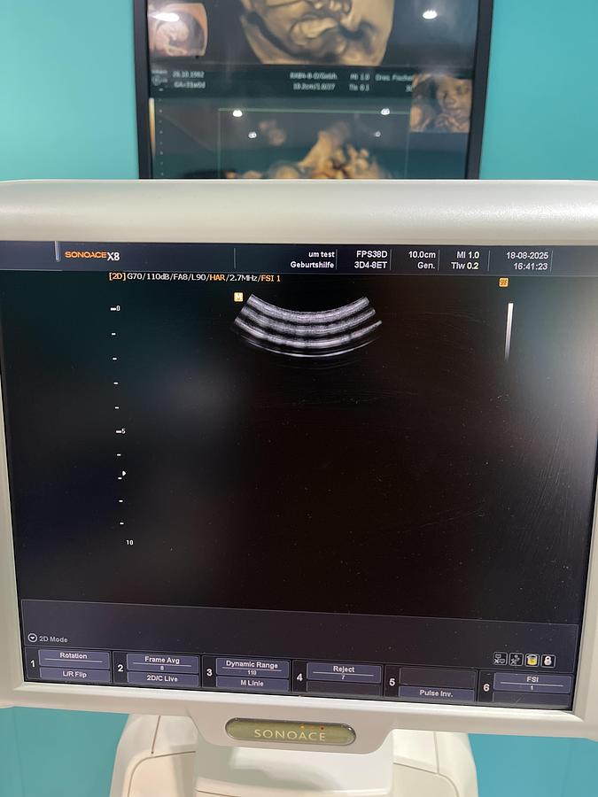 Gebraucht SonoAce X8 Ultraschallgerät mit drei Sonden und Drucker