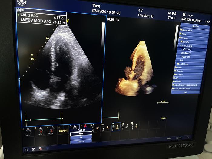 Gebraucht GE Vivid E9 XDClear Ultraschallgerät mit 2 Sonden
