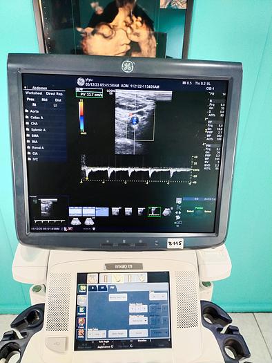 Gebraucht GE LOGIQ E9 Flachbildschirm-Ultraschallgerät