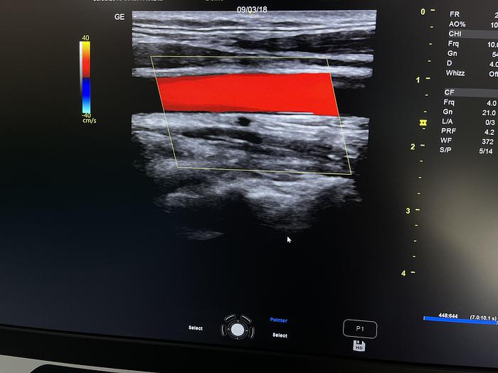 Gebraucht GE Versana Premier Ultraschallgerät mit drei Sonden