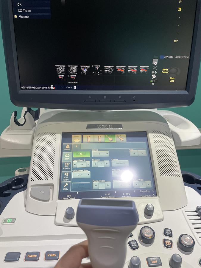 Gebraucht GE LOGIQ E9 Ultraschallgerät mit 2 Sonden und Drucker
