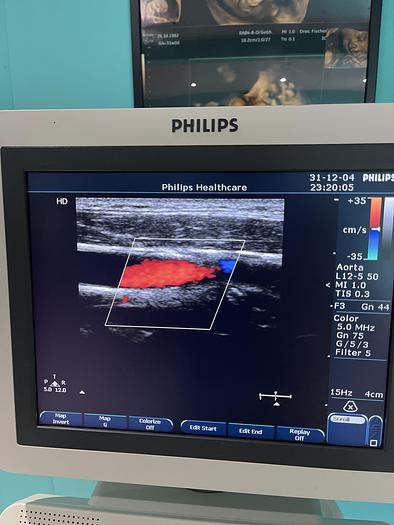 Gebraucht Philips HD7 Ultraschallgerät mit zwei Sonden