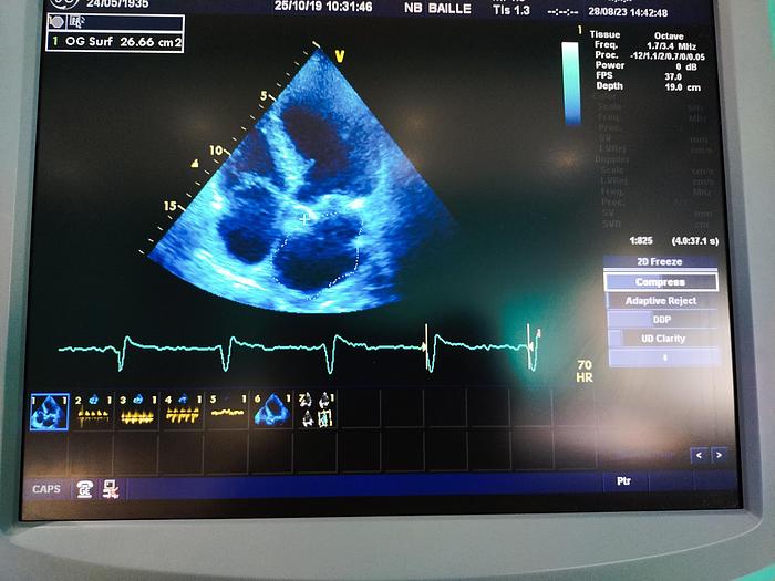 Gebraucht GE Vivid 7 Ultraschallgerät