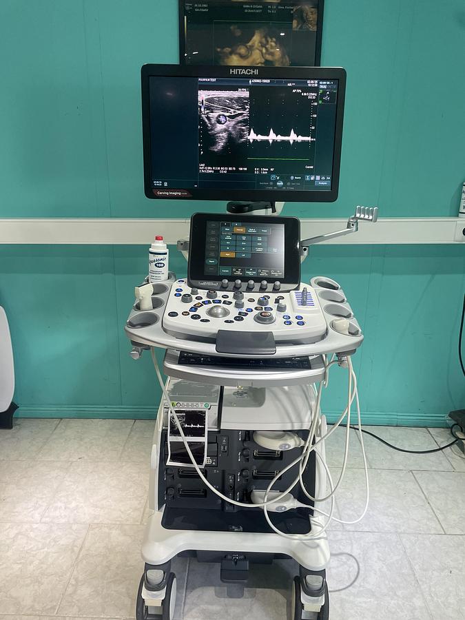 Gebraucht Hitachi ALOKA Arietta 850 Ultraschallgerät mit zwei Sonden und Drucker 