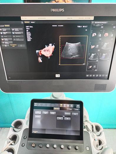 Gebraucht Philips V6-2  3D/4D  Volumen Ultraschallsonde