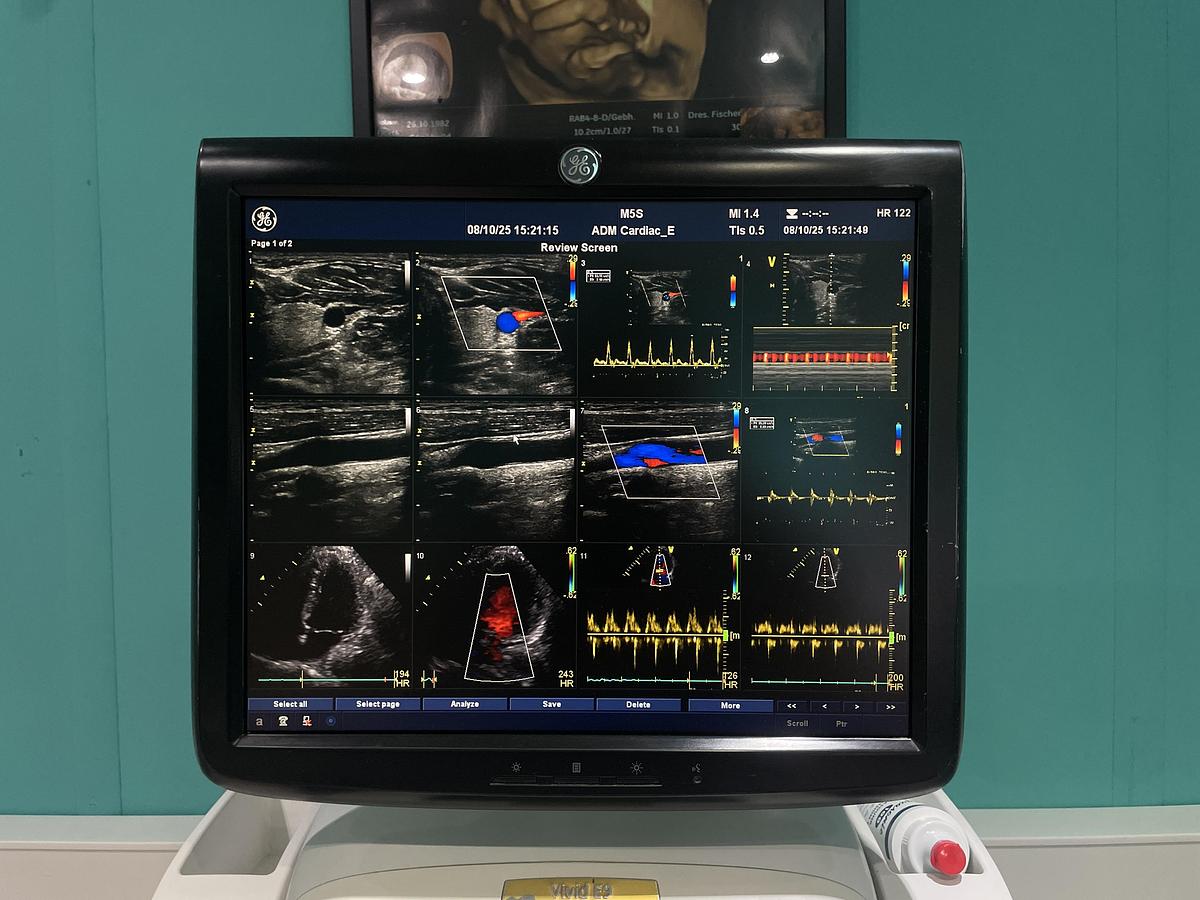 Gebraucht GE Vivid E9 Ultraschallgerät mit zwei Sonden und Drucker