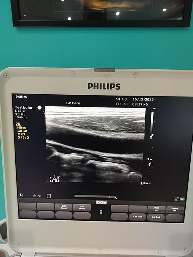 Gebraucht Philips CX50 Ultraschallgerät