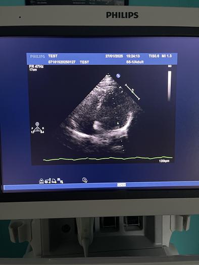 Used Philips iE33 HW G.1  xMatrix Ultraschallgerät mit S5-1 Kardiosonde und Drucker