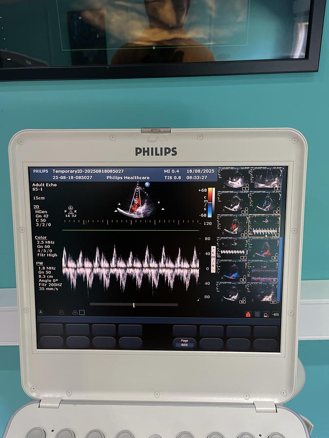 Gebraucht Philips CX50 Ultraschallgerät mit S5-1 Kardiosonde