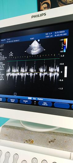 Gebraucht Philips HD11XE Ultraschallgerät mit 3 Sonde
