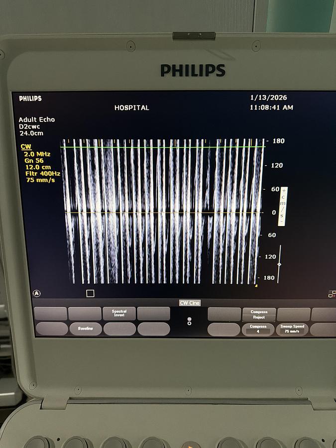 Gebraucht Philips D2cwc Pencil Ultraschallsonde 
