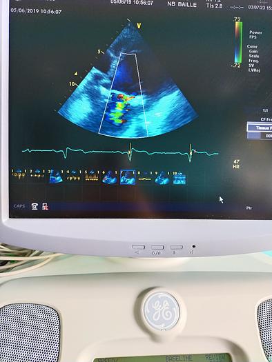 Gebraucht GE Vivid 7 Ultraschallgerät Dimension´08 mit 4D echo ,TEE Sonde ,Linear ,Sector