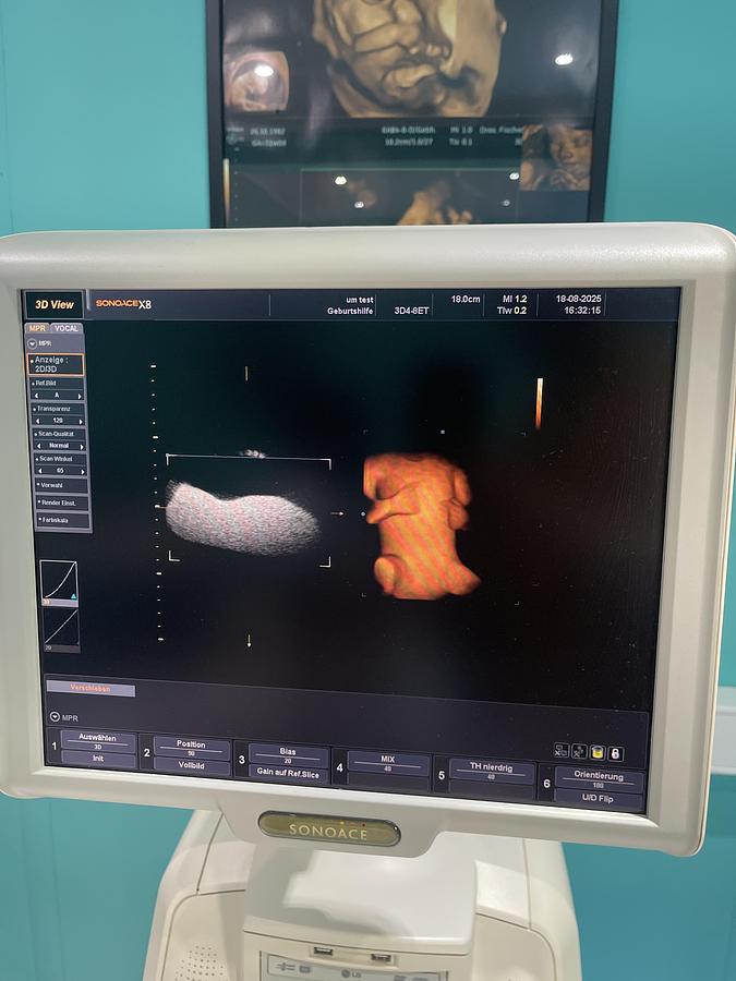 Gebraucht SonoAce X8 Ultraschallgerät mit drei Sonden und Drucker