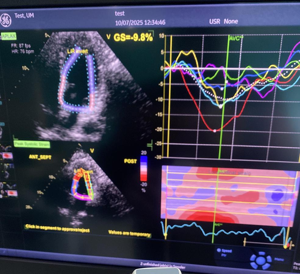 Gebraucht GE Vivid E95 V202 Ultraschallgerät mit M5Sc-D Kardiosonde