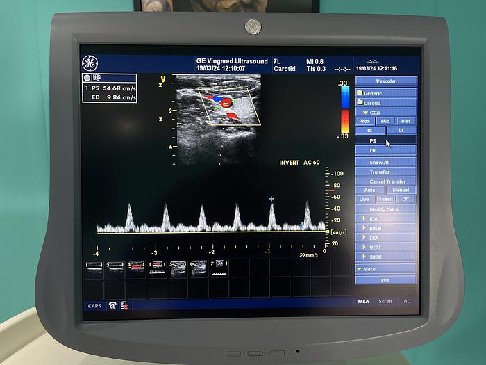Gebraucht GE 7L linear Ultraschallsonde 